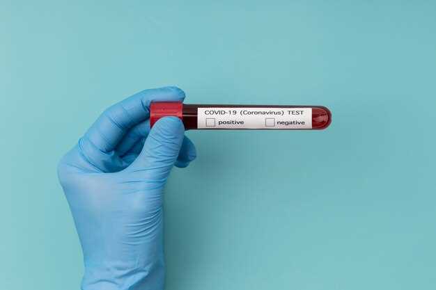 Виды тестов на ВИЧ и их особенности