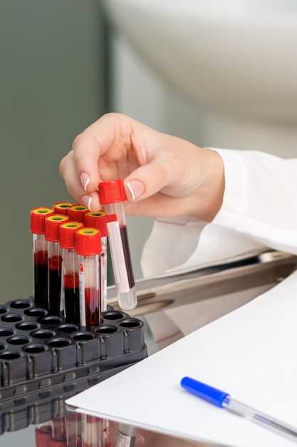 Что показывает анализ крови на уровень эластазы?
