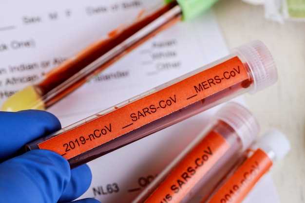 Способы анализа тромбоцитов в общем анализе крови