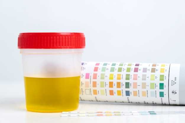 Как правильно сдать анализ на мочевую кислоту?