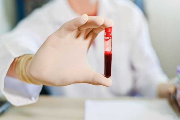 Основные показатели общего анализа крови