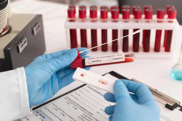 Как выполняется подготовка к общему анализу крови и как это влияет на результаты измерений гемоглобина?