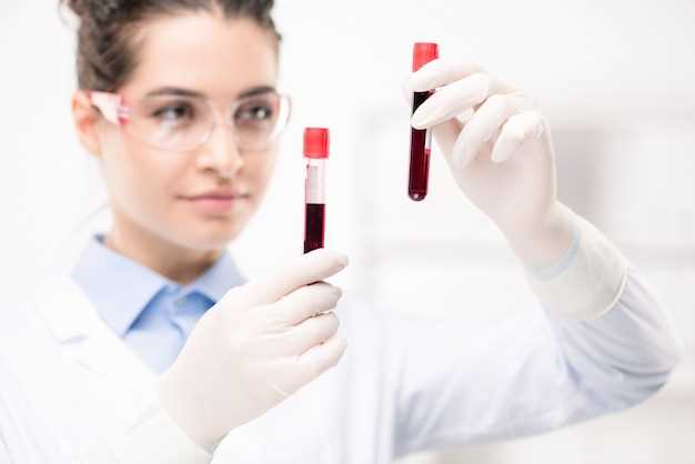 Измерение гемоглобина в общем анализе крови