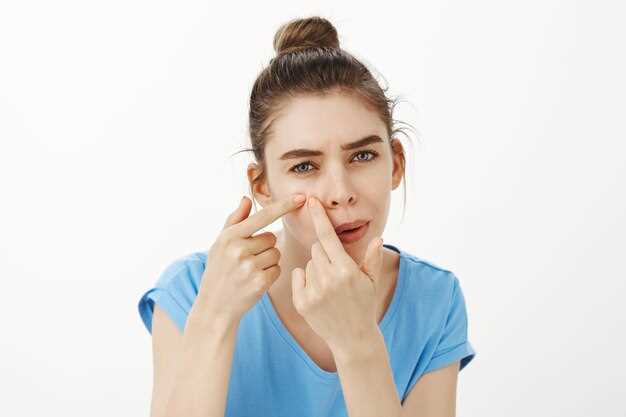 Причины отека слизистой носа